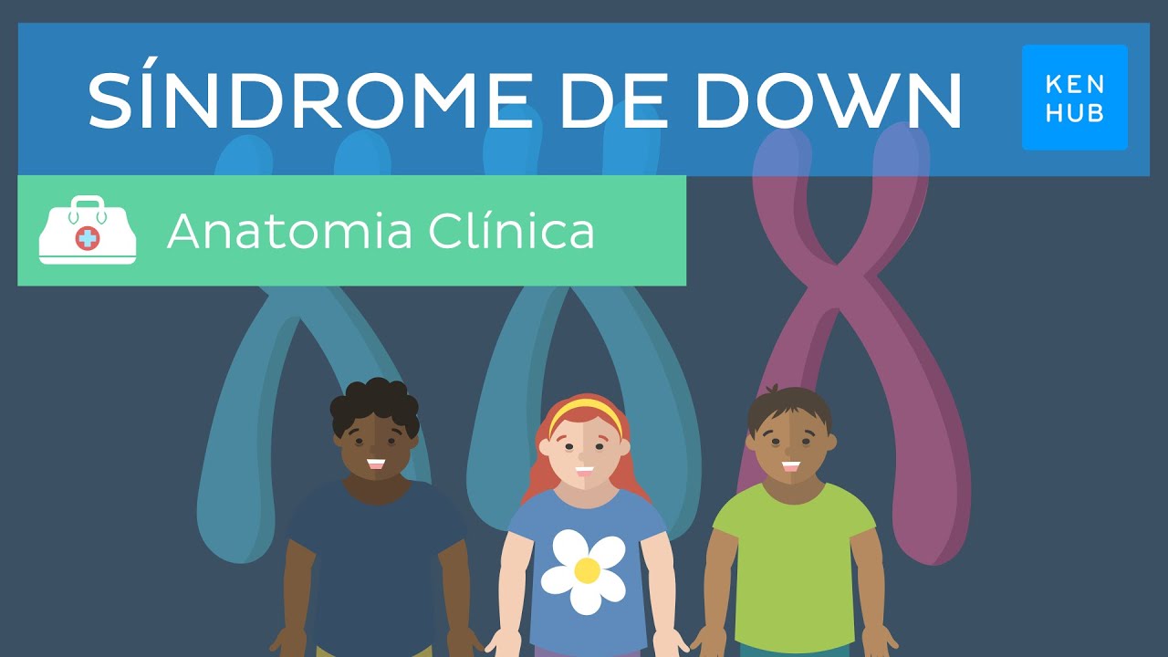 Síndrome de Down: Causas, características, diagnóstico e tratamento | Kenhub